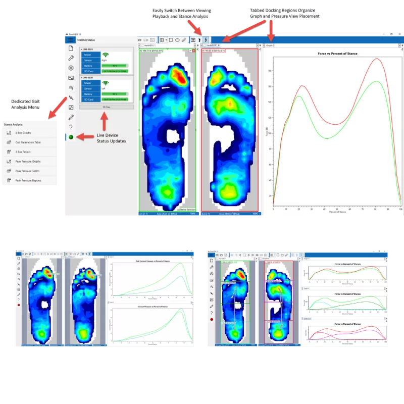 F-Scan™ GO - Système à semelles haute résolution sans fil