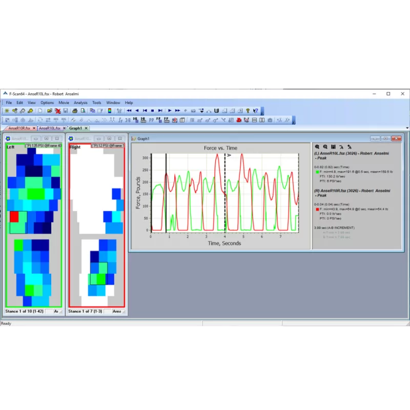 F-Scan 64™ - Semelles connectées à 64 capteurs de pression