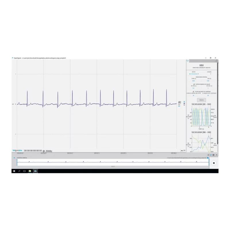Variabilité de la fréquence cardiaque (VRC)