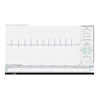 Variabilité de la fréquence cardiaque (VRC)