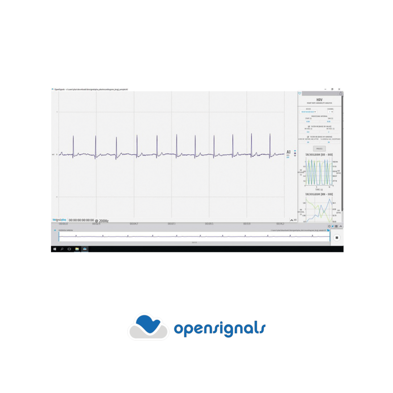 Variabilité de la fréquence cardiaque (VRC) pour OpenSignals (r)evolution|Biosignalsplux|Mescan