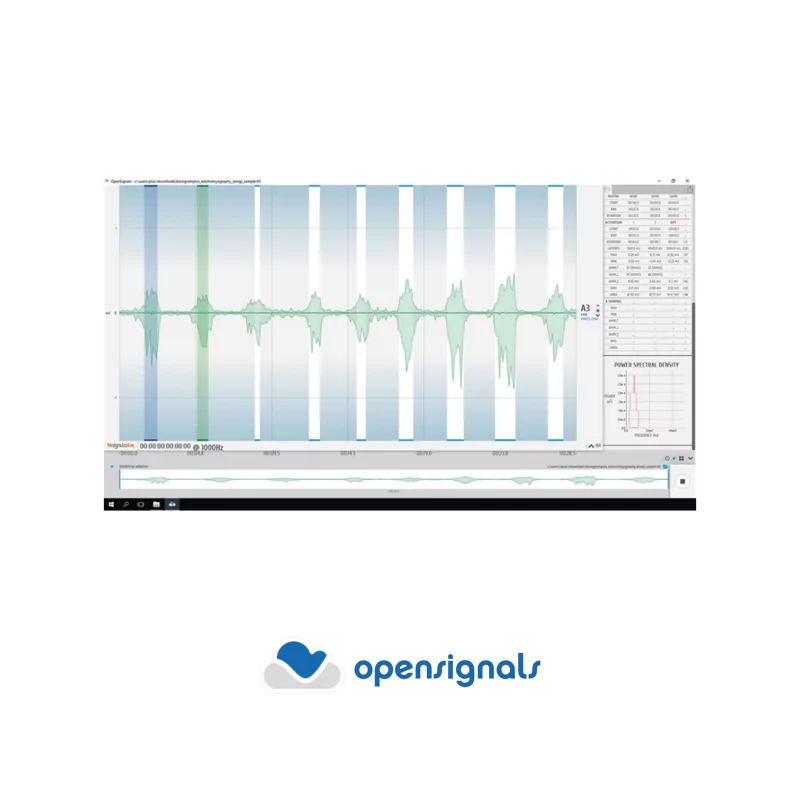 Analyse électromyographique (EMG) pour OpenSignals (r)evolution | Biosignalsplux | Mescan