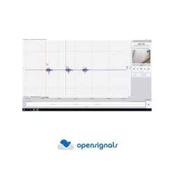 Synchronisation vidéo pour OpenSignals (r)evolution | Biosignalsplux | Mescan