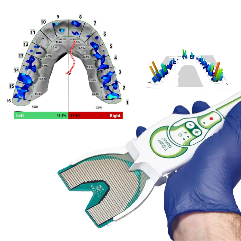 T-Scan® Novus™ - Mesure dynamique des contacts dentaires : forces, localisation, chronologie. Analyse occlusale numérique.