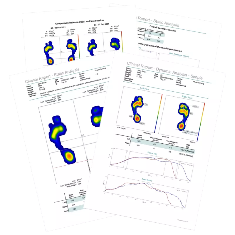 Plateforme baropodométrique PhysioSensing Podo | Mescan