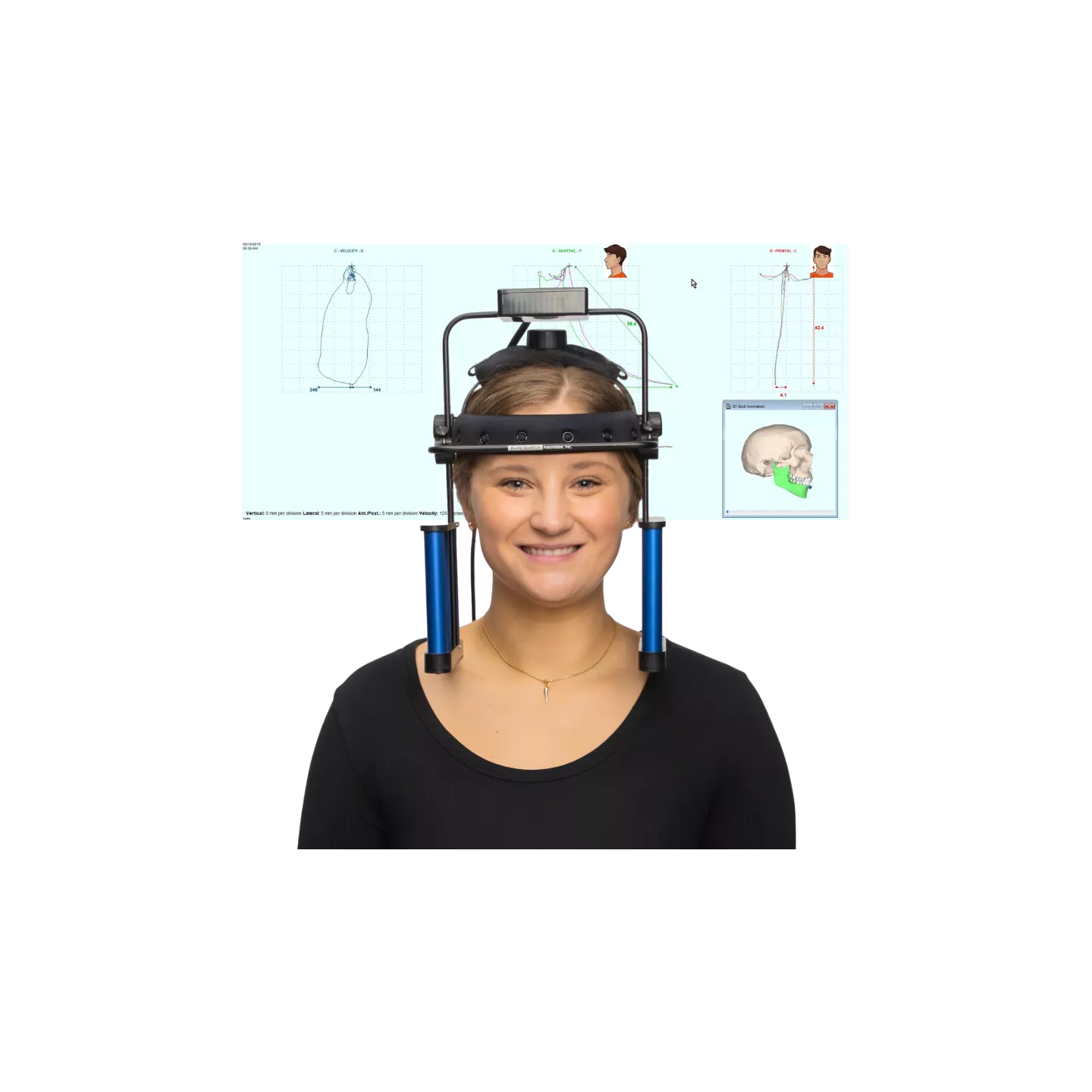 JT-3D Jaw Tracker