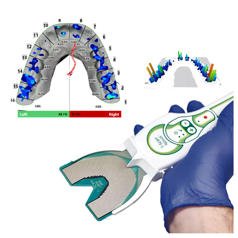 T-Scan Novus™