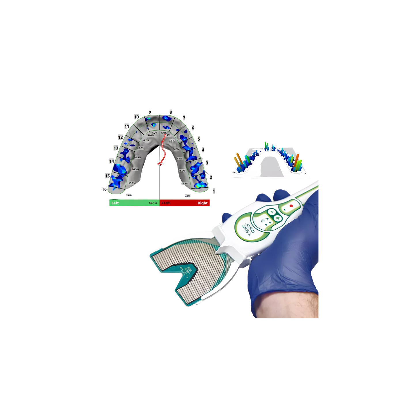 T-Scan Novus™