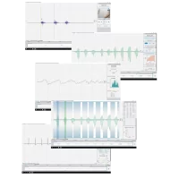 Logiciel multiplateformes Opensignals