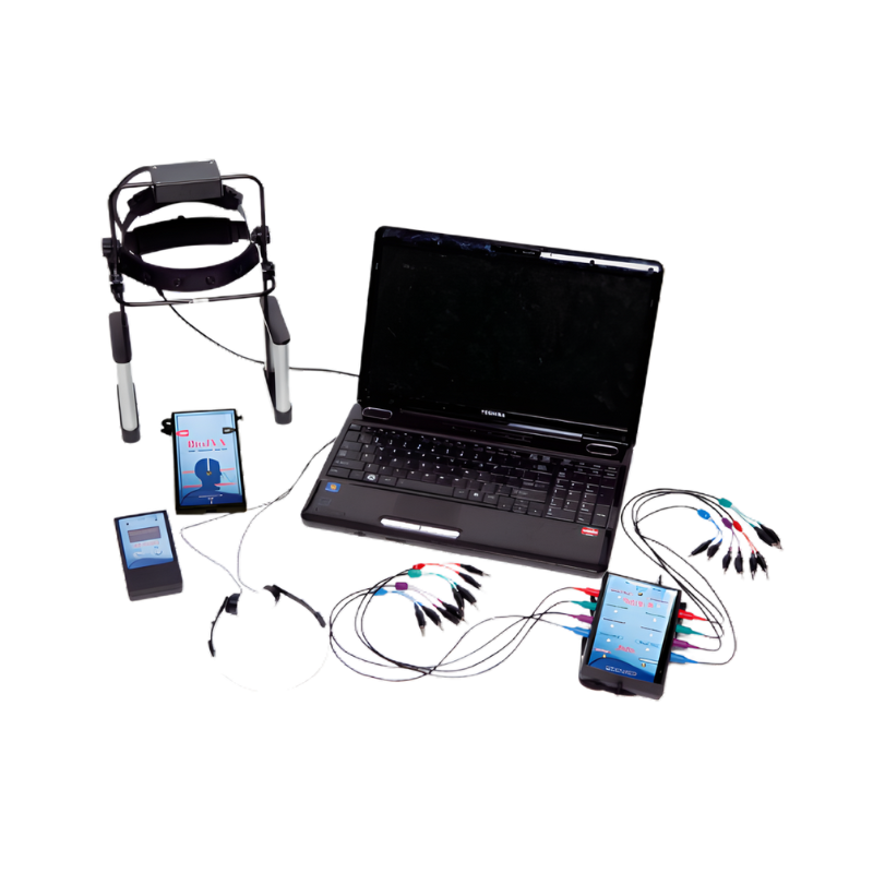 Extensométrie vidéo . Mesure de déformations et déplacements par DIC 2D / 3D Imetrum