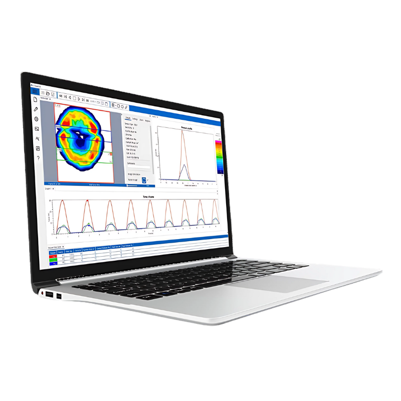 Recevoir une offre de prix pour uneconfiguration Tekscan I-Scan