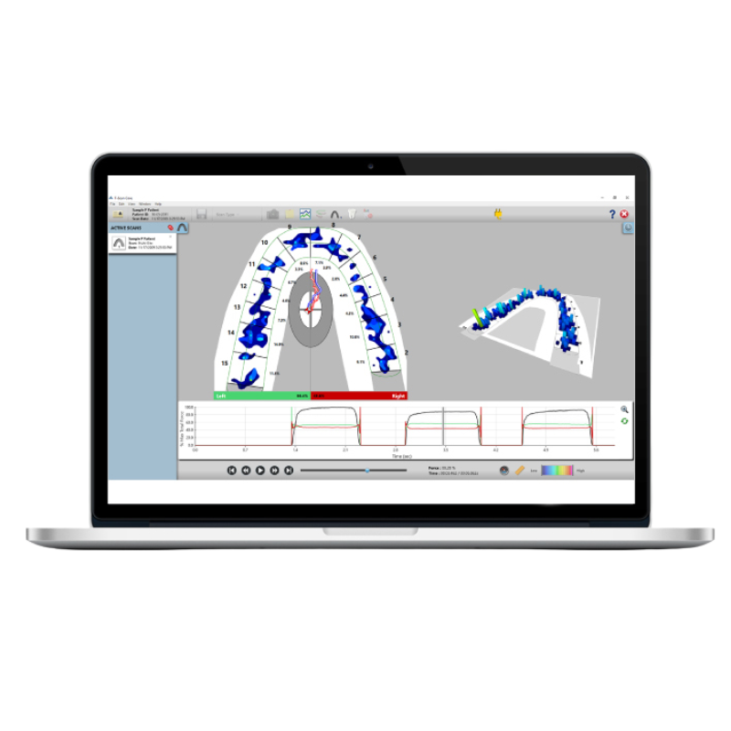 Extensomètres Imetrum Vector, 2 modèles axiaux (Vector U70 et Vector U200) et un modèle biaxial (Vector B80)