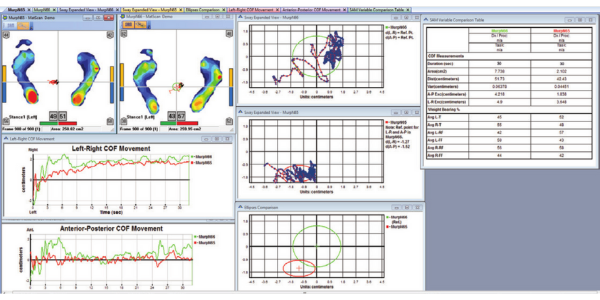 Analyse de l'équilibre, mesure de l'oscillation avec le système Tekscan à tapis d'analyse de la marche Strideway - Distribution Mescan