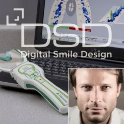 Le Dr Christian Coachman de Digital Smile Design explique l'importance des mesures occlusales